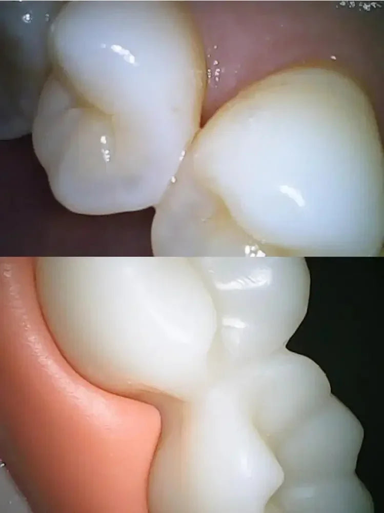 CÃMERA VISUAL SEM FIO INTRAORAL